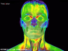 thermal imaging head 1